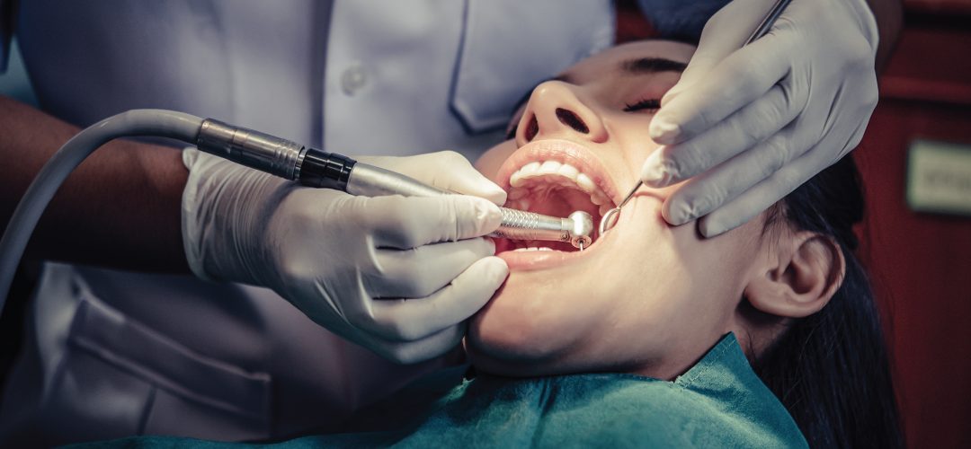 Affordable dental fillings at Roseman Dental.