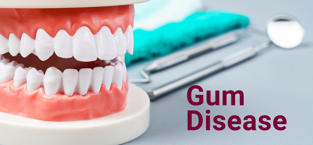 Keeping Your Gums Healthy