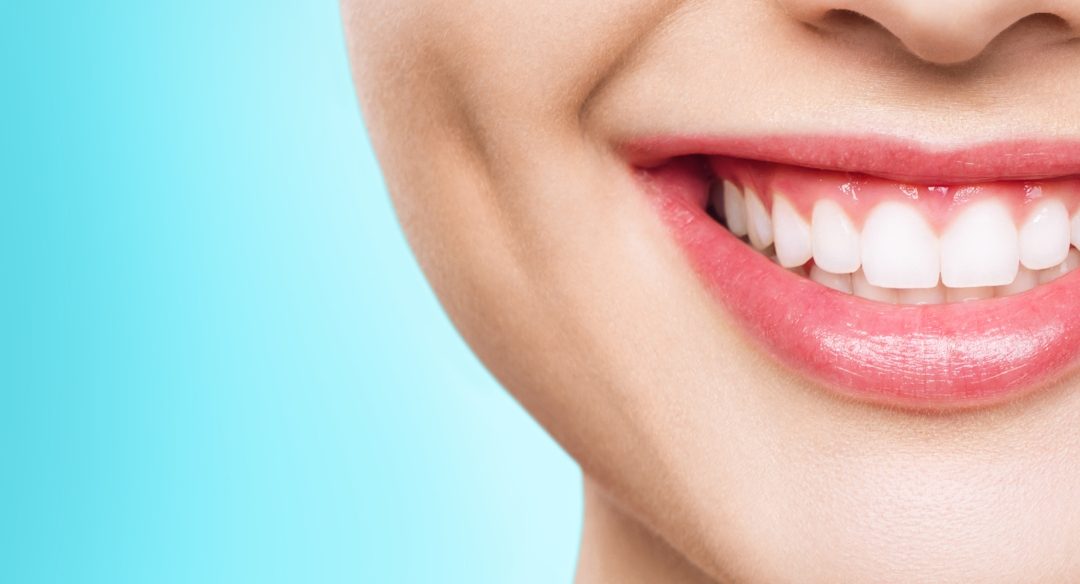 Teeth Whitening: The Pros & Cons